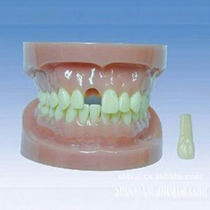 Removable and rootless Standard tooth model